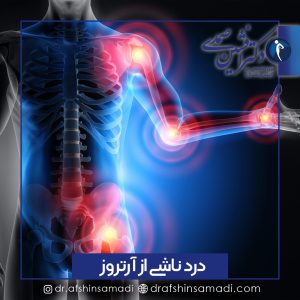 درمان دردهای ناشی از آرتروز