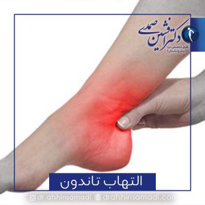 التهاب تاندون مچ پا (تاندون آشیل)