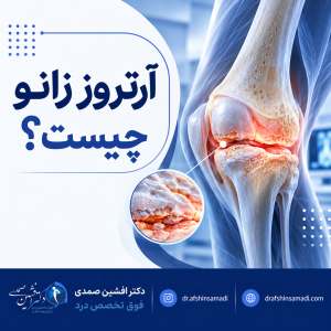 آرتروز زانو چیست؟