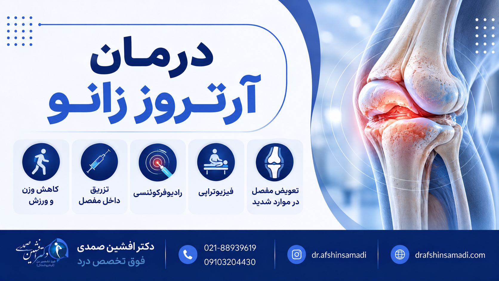 درمان آرتروز زانو