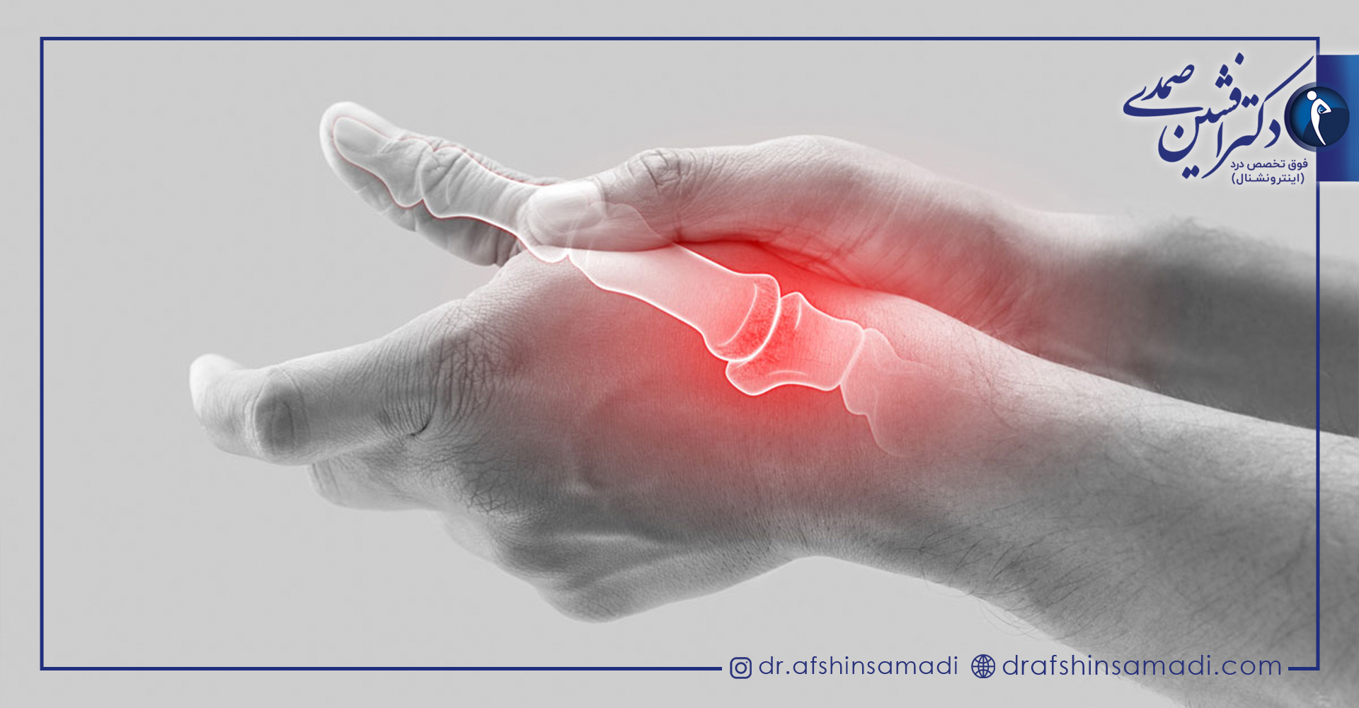 علائم بیماری آرتریت روماتوئید