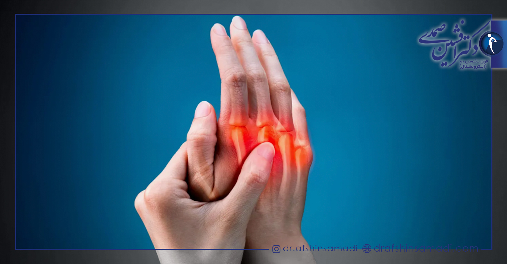 تشخیص دادن بیماری آرتریت روماتوئید