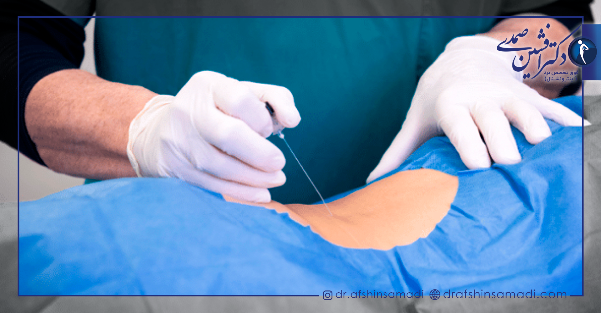 درمان کردن درد کمر با تزریق ترانس فورامینال