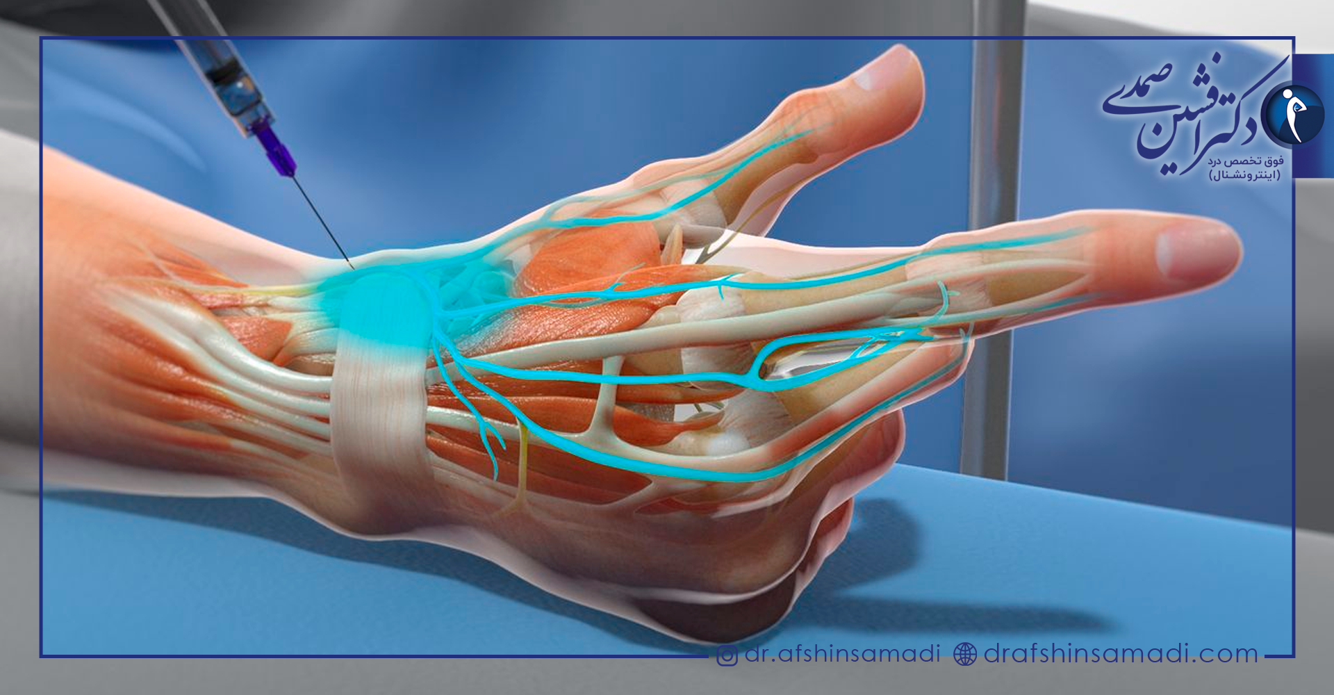تاثیر بلاک عصبی بر بدن