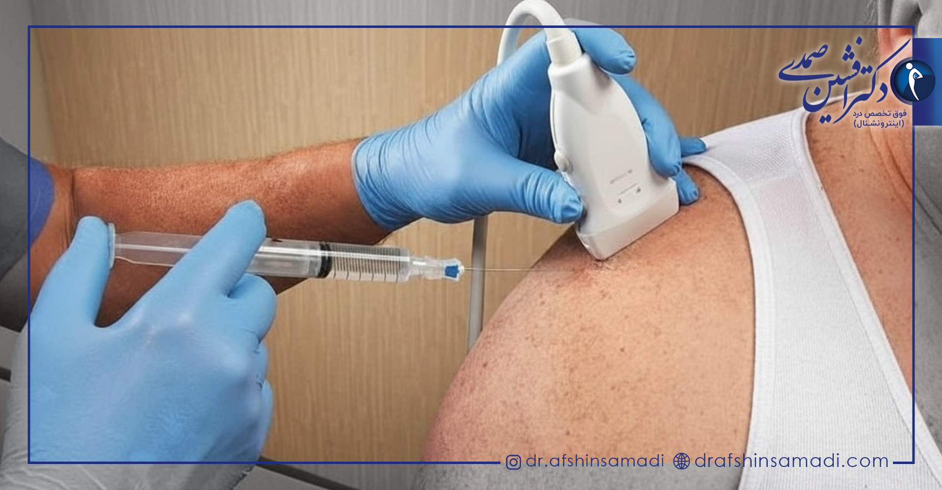 نحوه تزریق کورتون به مفصل شانه