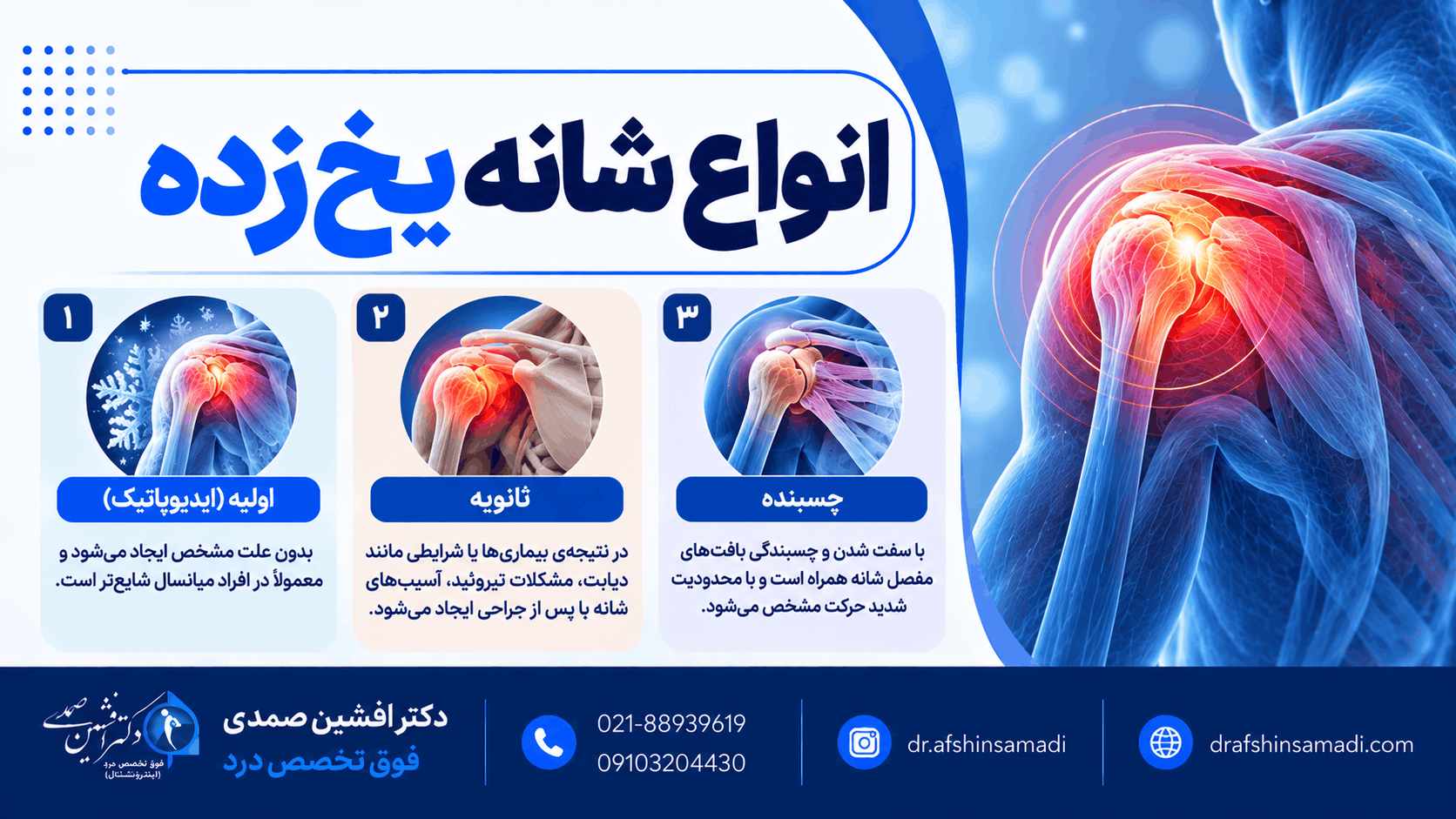 انواع شانه یخ زده