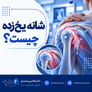 شانه یخ زده چیست؟