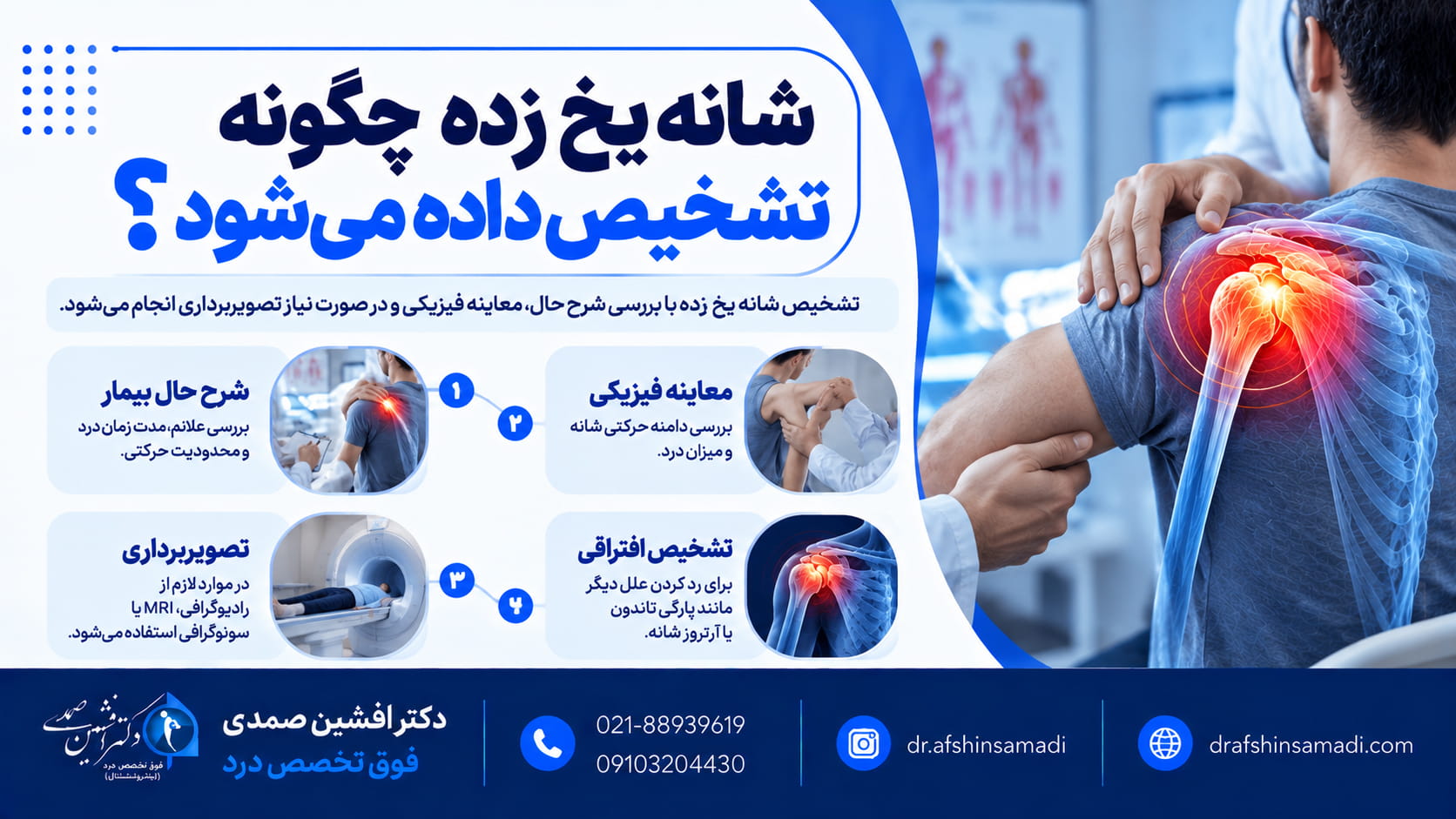 شانه یخ زده چگونه تشخیص داده میشود؟