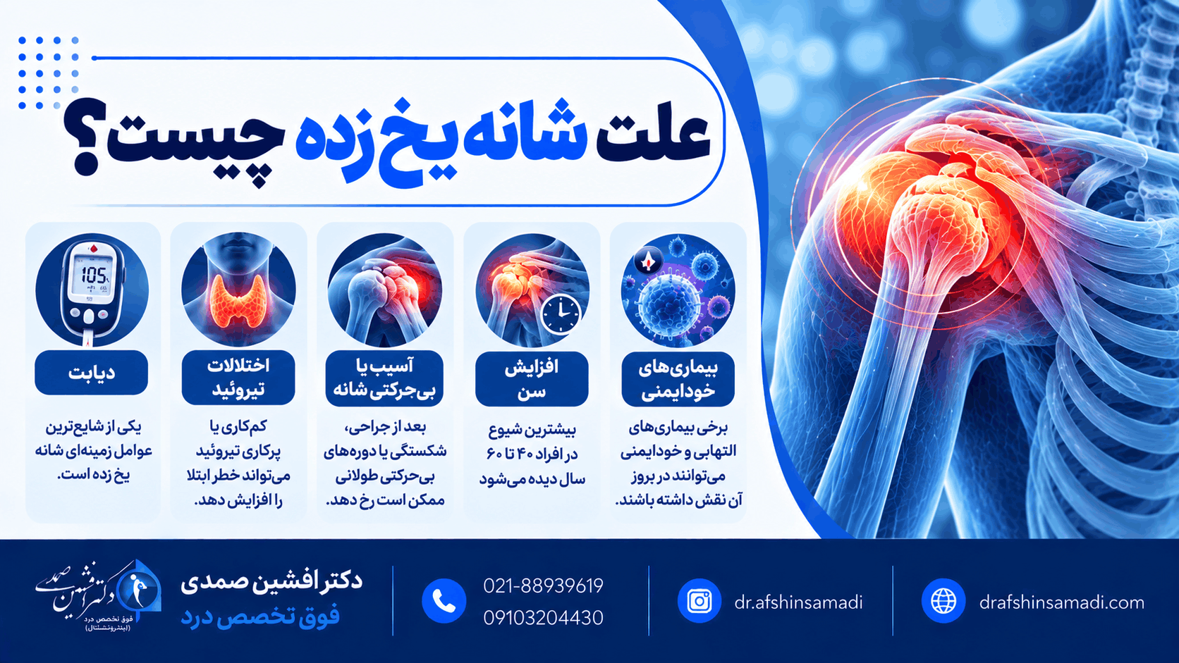 علت شانه یخ زده چیست؟