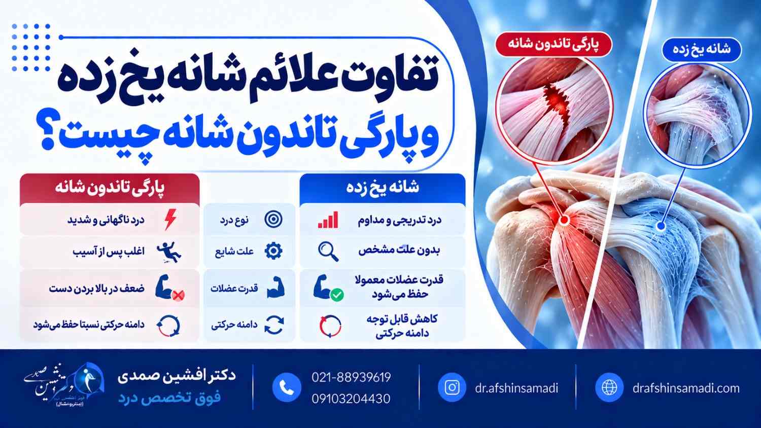 تفاوت علائم شانه یخ زده و پارگی تاندون شانه چیست؟