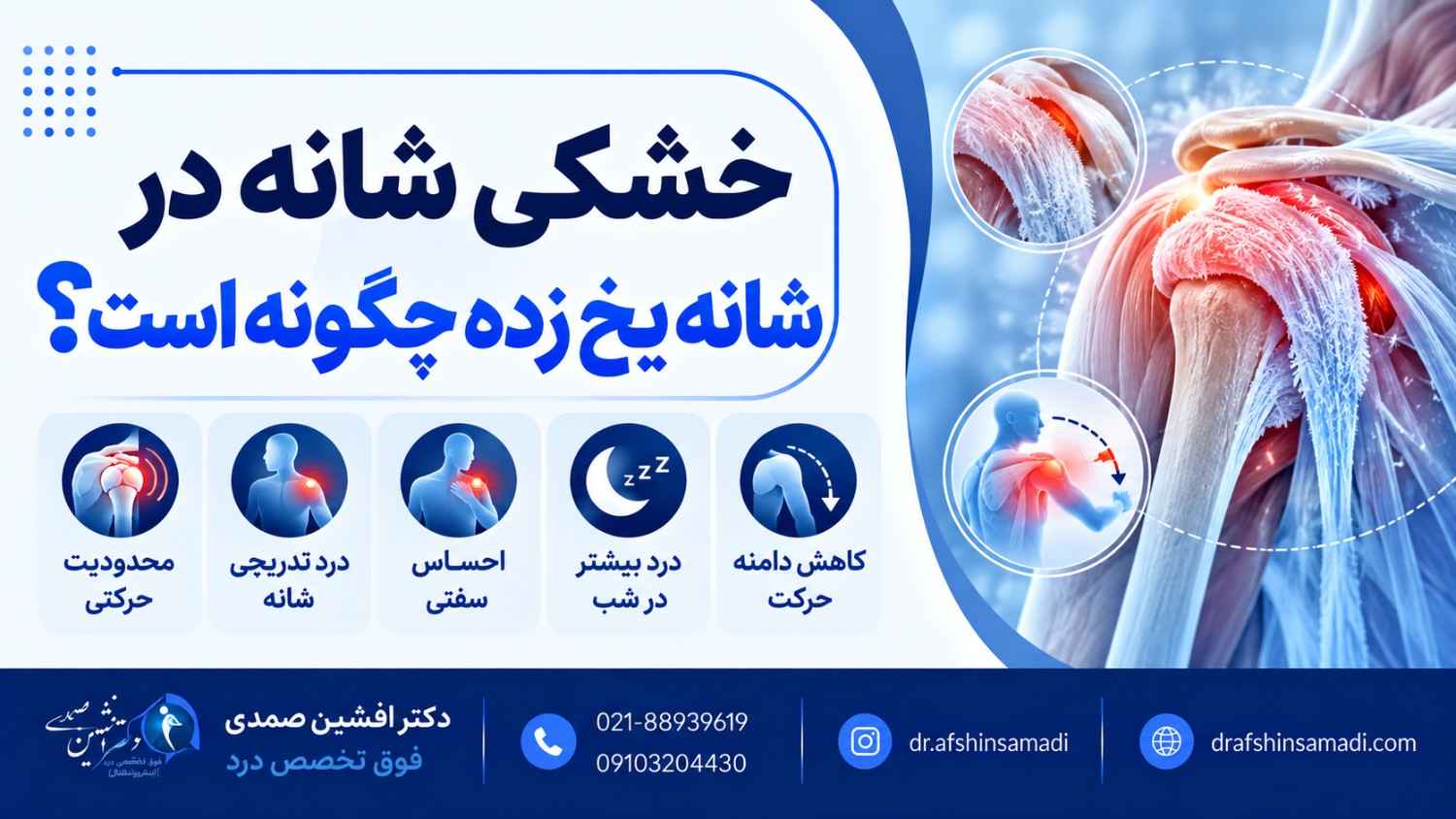 خشکی شانه در شانه یخ زده چگونه است؟