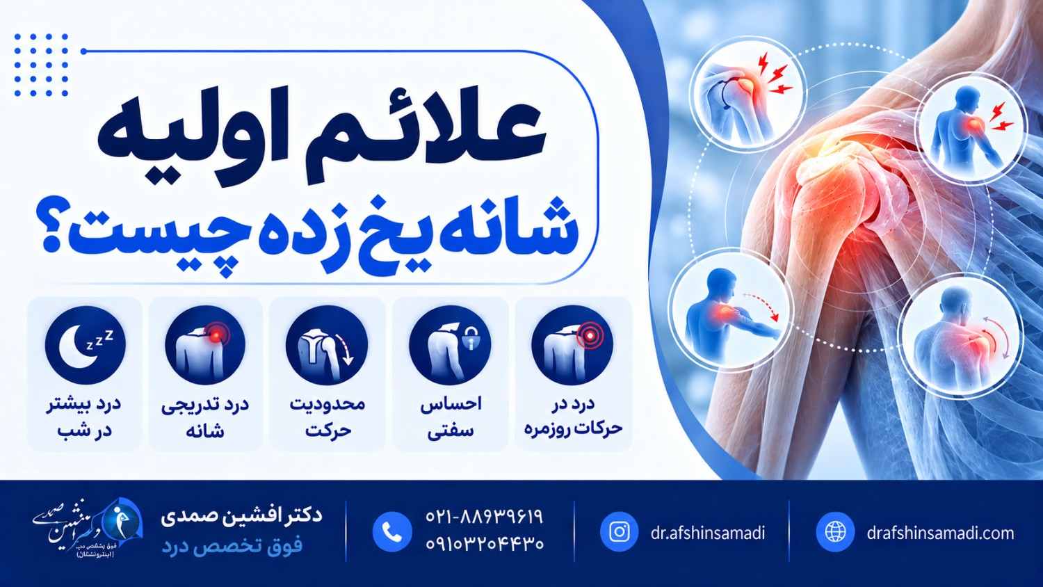 علائم اولیه شانه یخ زده چیست؟