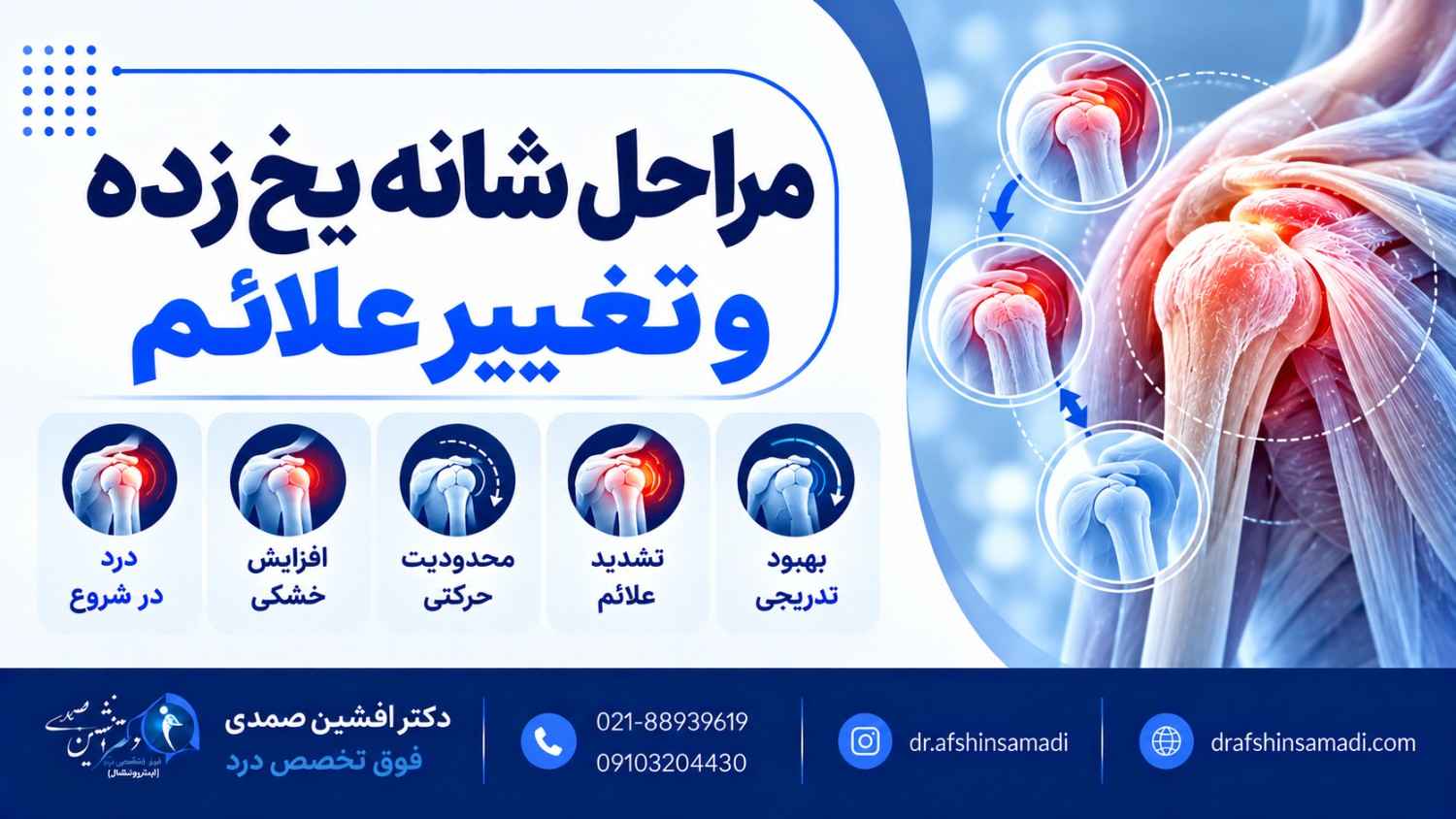 مراحل شانه یخ زده و تغییر علائم