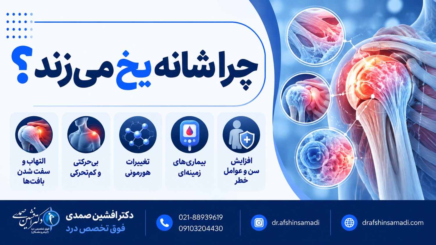 چرا شانه یخ می‌زند؟